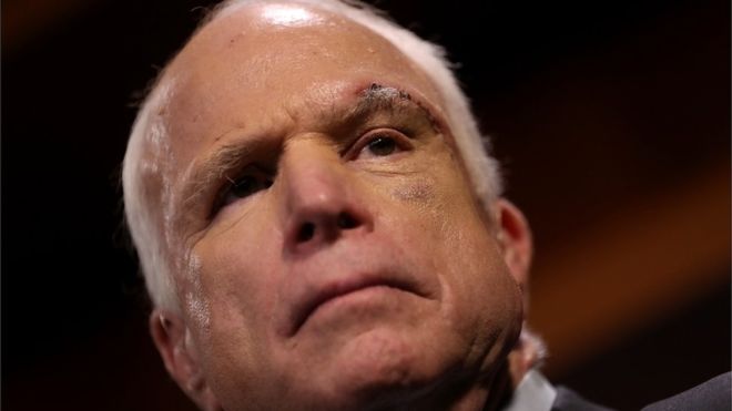 Zionist Traitor John McCain Opts to End Cancer Treatment